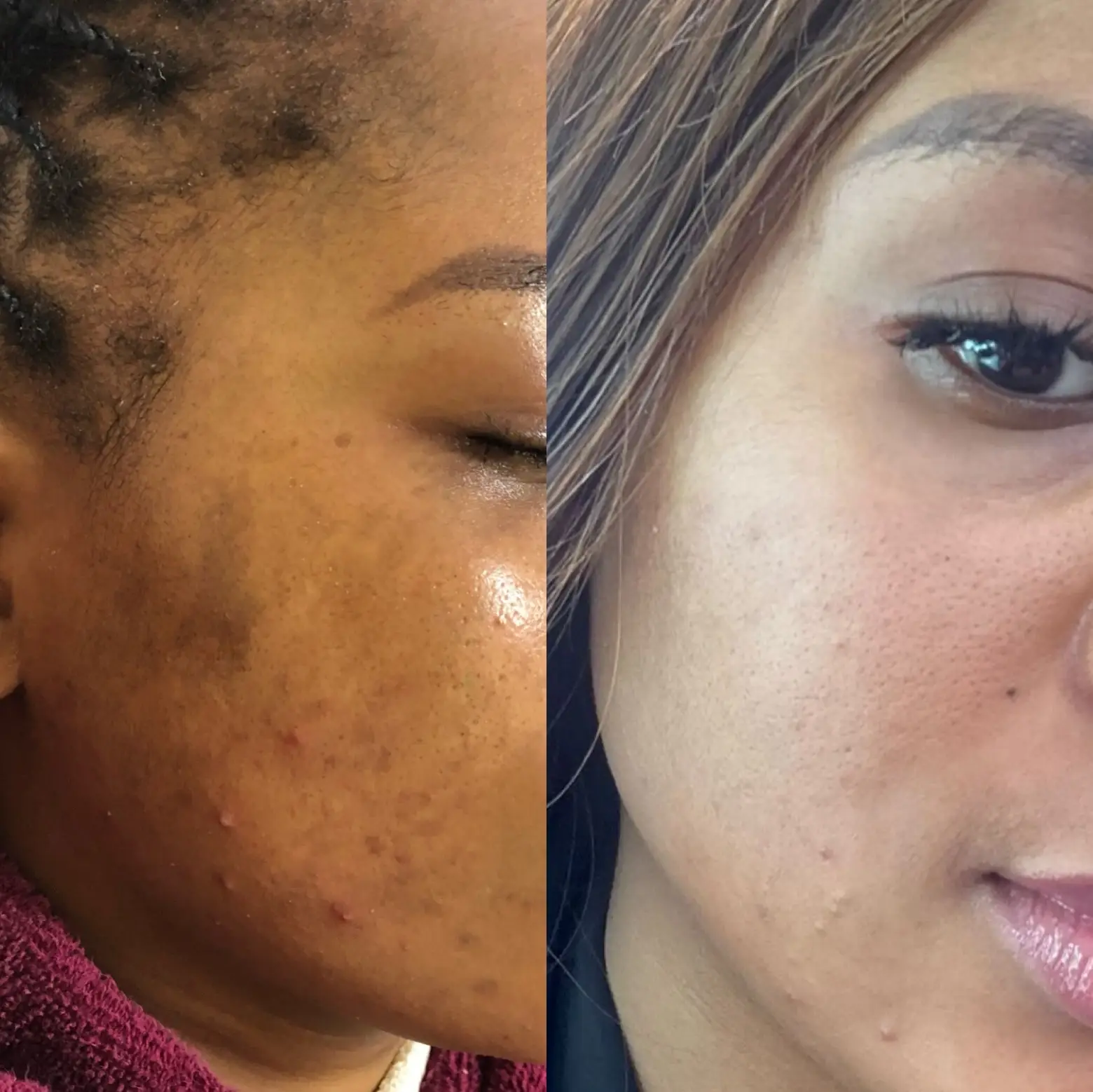 Advanced Skincare Rejuvenation Treatment at Fae Lifestyle