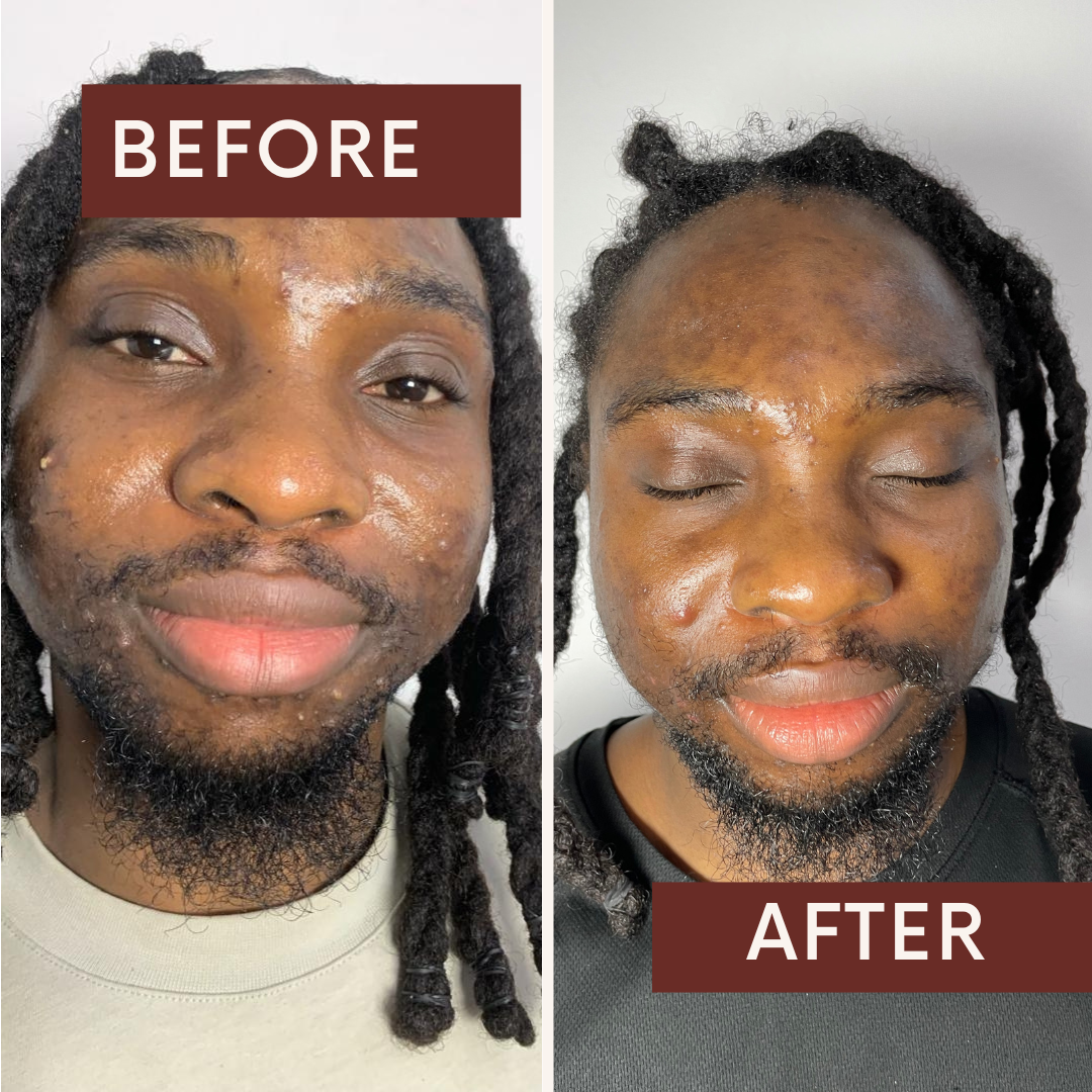 Premium Clinical Skincare Facial Session at Fae Lifestyle
